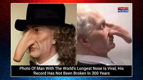 Worlds Longest Nose WATCH: Man With The World's Largest Nose Speaks