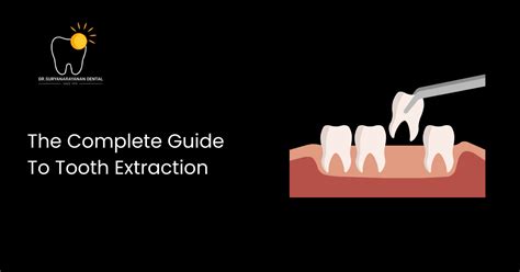 Image result for Basic Tooth Extraction