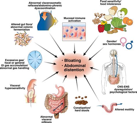 Bloating and Abdominal Distention: Not So Poorly Understood Anymore! - Gastroenterology