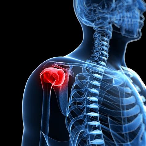 SLAP Tear Shoulder Surgery | Best Orthopedic Surgeons