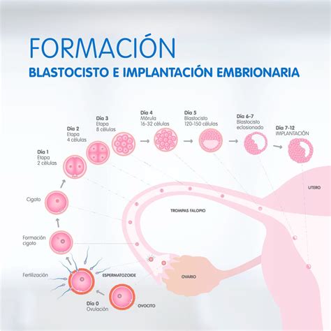 Sangrado de Implantación, todo lo que deberías saber - IVI Blog