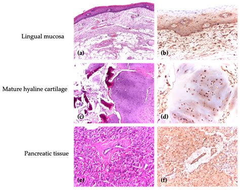 Immunohistochemical Expression of Differentiated Embryonic Chondrocyte ...