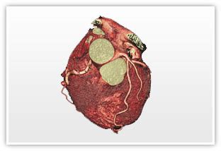 Health 360 plus includes Diagnostic Testing that includes Coronary CT ...