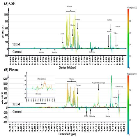 1H Nuclear Magnetic Resonance (NMR)-Based Cerebrospinal Fluid and ...