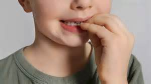 Why nail biting is more than just a bad habit: It may cause serious ...