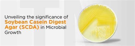 Infection vs Intoxication in Food Microbiology: What’s the Difference ...