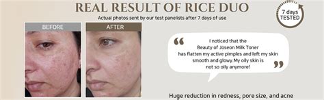 Beauty of Joseon Glow Replenishing Rice Toner (150 Ml) | Hydrating ...