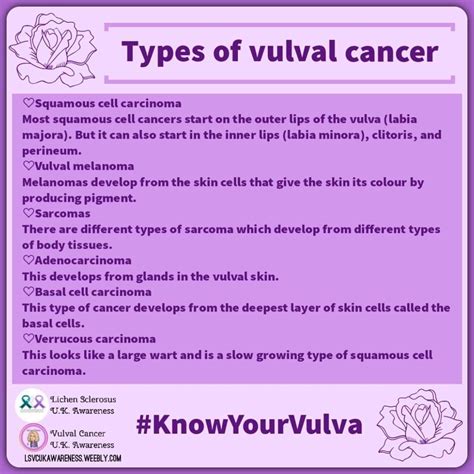 Vulvar Cancer Melanoma