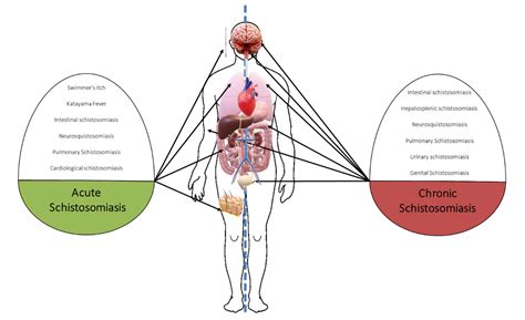 Clinical Spectrum of Schistosomiasis: An Update