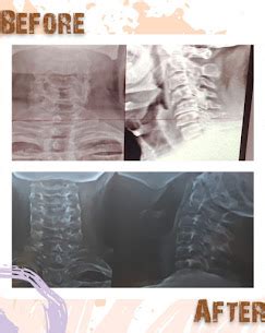 Physio Quantum | +919210490009 | Best physiotherapiest in Sanik Farm ...