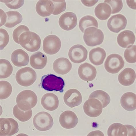 Image result for Target Cells