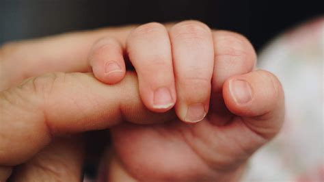 is your newborns skin and eyes yellow its not negligence know these 5 ...