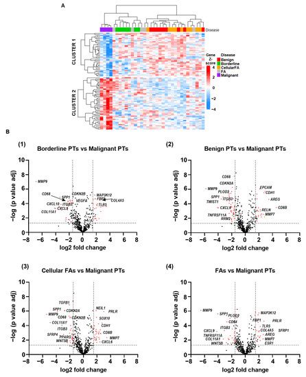 Gene Expression Profiling of Fibroepithelial Lesions of the Breast