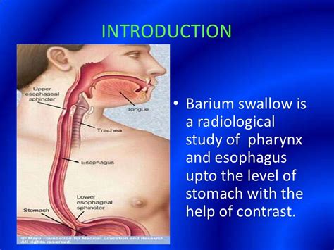 Image result for Modified Barium Swallow Study Basic