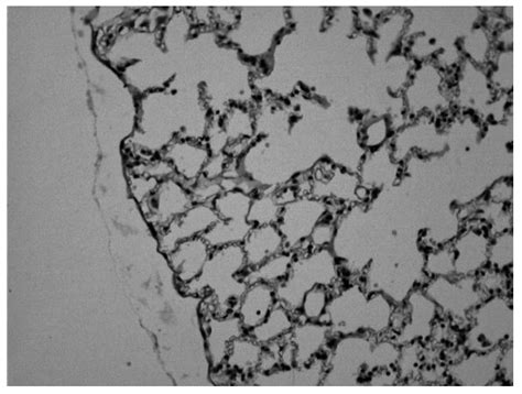 Novel Theophylline Oral Formulation for Pediatric Use and Biological ...