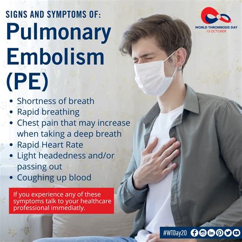 Pulmonary Embolism Causes