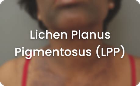 DermaClinix | Skin Concerns