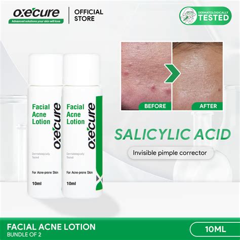 [NEAR EXPIRY: SEPT 2025] OXECURE 2% Salicylic Acid Facial Acne Lotion 10ml Bundle | Shopee ...