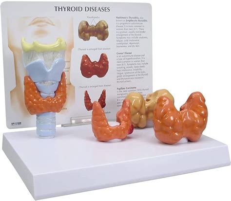 Buy LBYLYH Thyroid System Model Of The Human Body Anatomy Thyroid ...