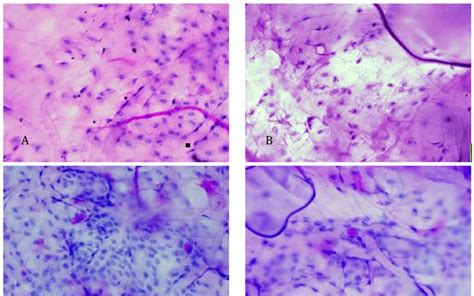 https://www.researchgate.net/publication/366439403/figure/fig1/AS%3A11431281108662386%401671543044747/Conjunctiva-impression-cytology-photomicrograph-magnification-40x-Scale-bar-10-m-A.png