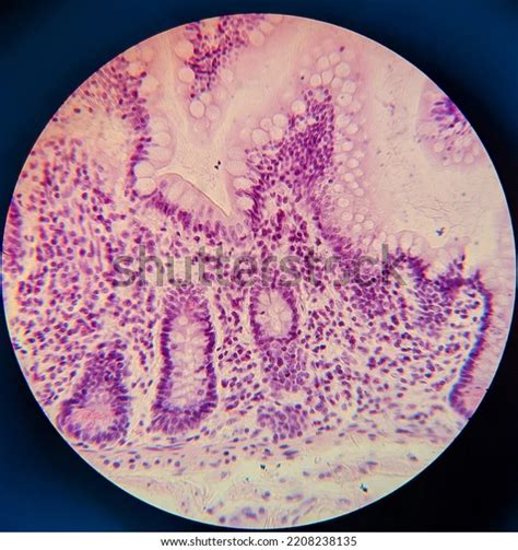 Image result for Tissue Sample Drawing Under Microscope