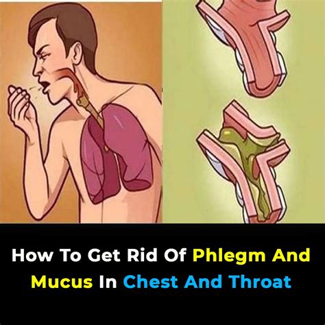 8 Ways To Get Rid Of Phlegm And Mucus In Chest And Throat