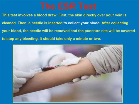 CRP test & ESR test | PPTX