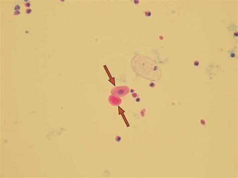 What Are Squamous Epithelial Cells In Urine Mean at Phoebe Colman blog