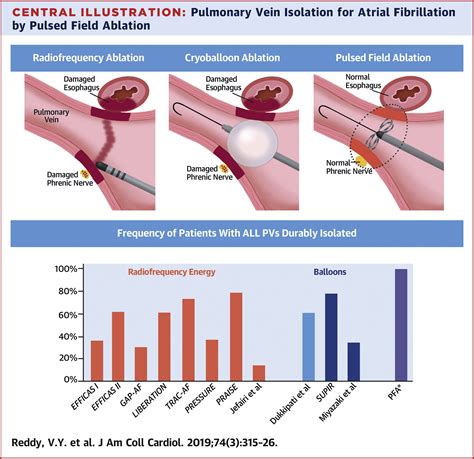 Pulsed Field Ablation for Pulmonary Vein Isolation in Atrial ...