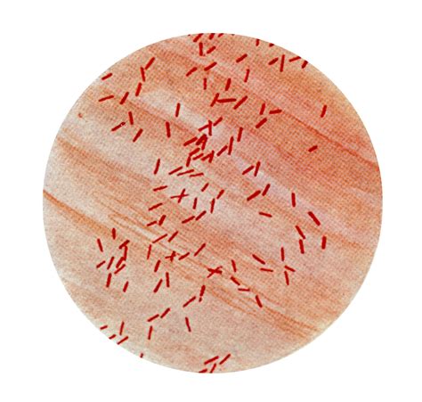 Free picture: photomicrograph, escherichia coli, bacillus, coli ...