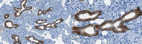 Anti-Sodium-Iodide Symporter Antibody, C-terminal 2 | ABC1454-25UL