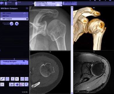 CT - Zwanger-Pesiri Radiology