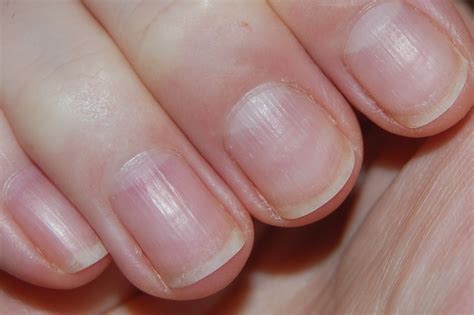 Bumpy Nails 的图像结果