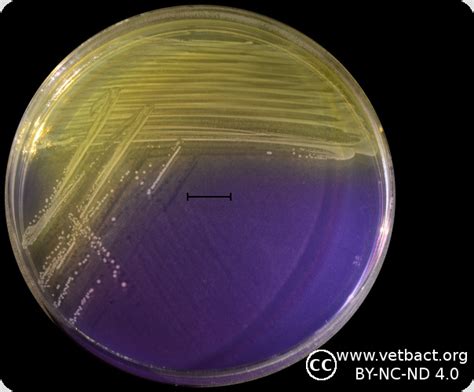 Image result for Enterococcus Faecalis MSA Plate