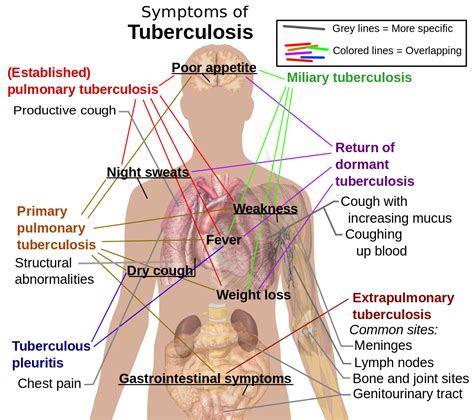 Infection Landscapes: Tuberculosis