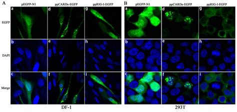 Pigeon RIG-I Function in Innate Immunity against H9N2 IAV and IBDV
