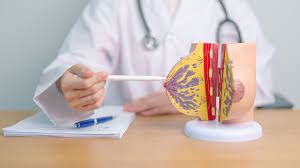 Image result for Linear Grogramming Problem Brain Map