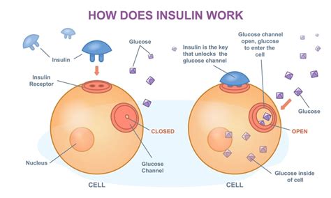 Image result for Insulin Management Algorithm