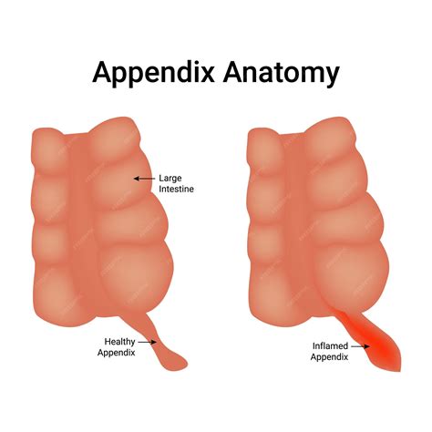 Image result for Appendix Structure