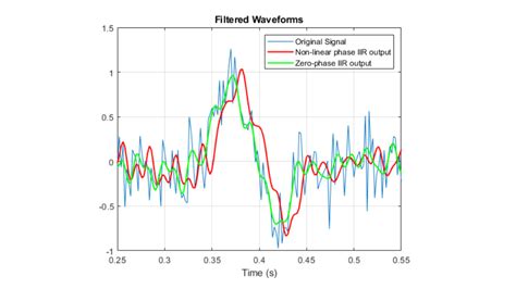 Image result for Signal Processing MATLAB