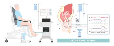 What Is Urodynamic Testing