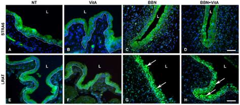 Vitamin A Rich Diet Diminishes Early Urothelial Carcinogenesis by ...