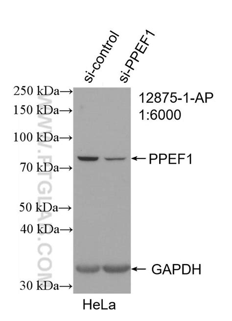 PPEF1 antibody (12875-1-AP) | Proteintech