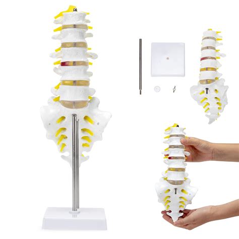 Buy SKUMOD Lumbar Spine Anatomy Model-Human Lumbosacral Segment Model ...