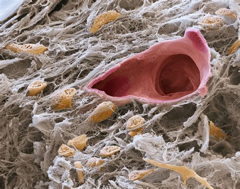 Image result for Pulp Extraction Tooth