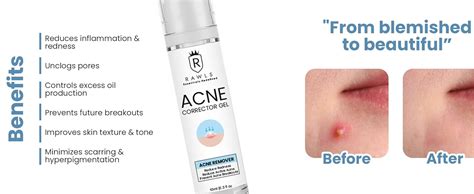 Rawls Corrector Gel for Active Acne & Redness Reduction, Breakout ...
