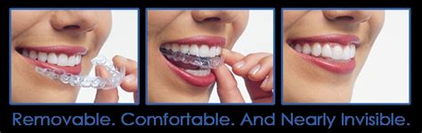 Corporate Dental Plans & Invisalign in Madurai | Agaram Dental