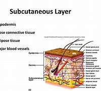 subcutaneous tissue 的图像结果