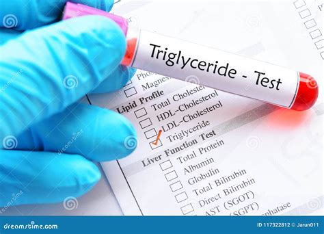 Blood Sample Tube for Triglyceride Test Stock Photo - Image of hematology, medicine: 117322812