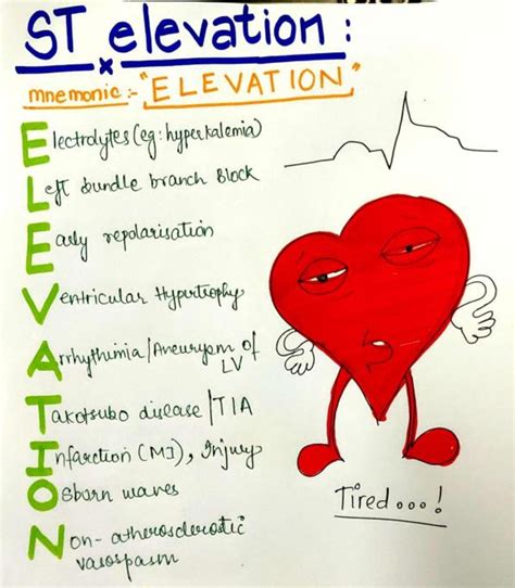 ST Elevation Causes on ECG - ELEVATION Mnemonic
